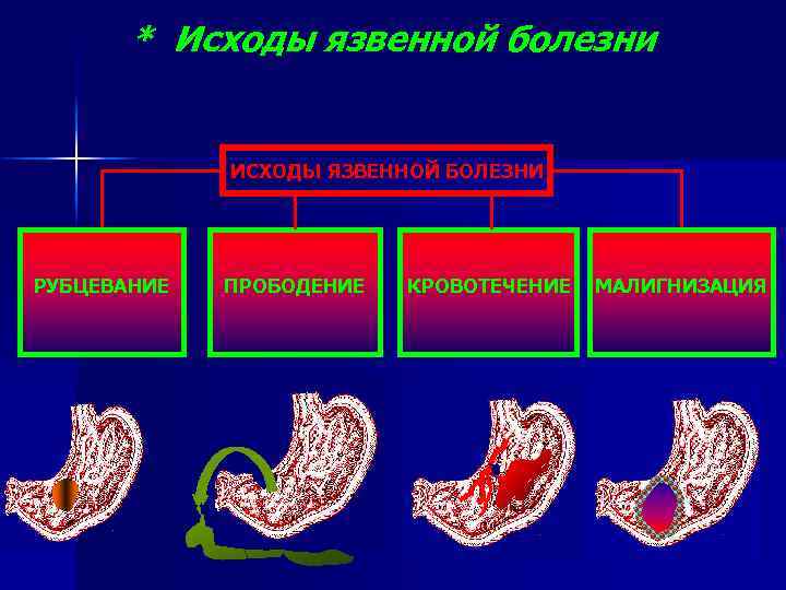 * Исходы язвенной болезни ИСХОДЫ ЯЗВЕННОЙ БОЛЕЗНИ РУБЦЕВАНИЕ ПРОБОДЕНИЕ КРОВОТЕЧЕНИЕ МАЛИГНИЗАЦИЯ 