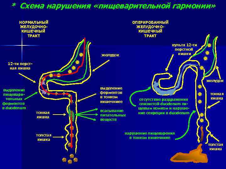 * Схема нарушения «пищеварительной гармонии» НОРМАЛЬНЫЙ ЖЕЛУДОЧНОКИШЕЧНЫЙ ТРАКТ ОПЕРИРОВАННЫЙ ЖЕЛУДОЧНОКИШЕЧНЫЙ ТРАКТ культя 12 -ти