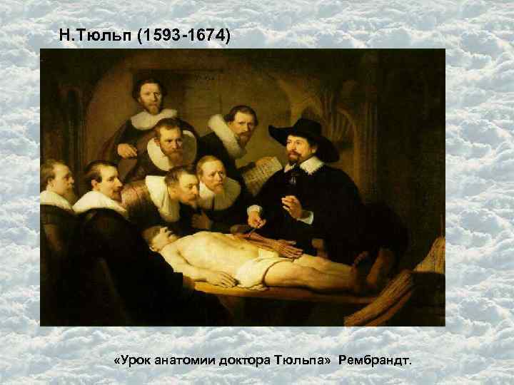 Н. Тюльп (1593 -1674) «Урок анатомии доктора Тюльпа» Рембрандт. 