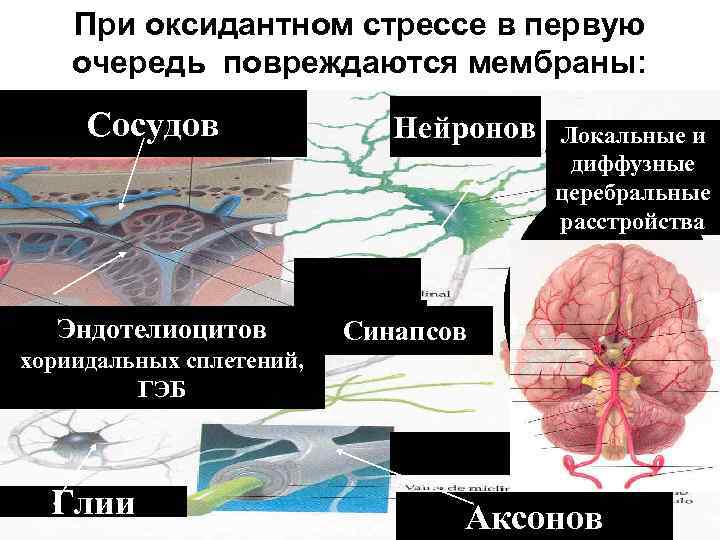 При оксидантном стрессе в первую очередь повреждаются мембраны: Сосудов Эндотелиоцитов Нейронов Локальные и диффузные
