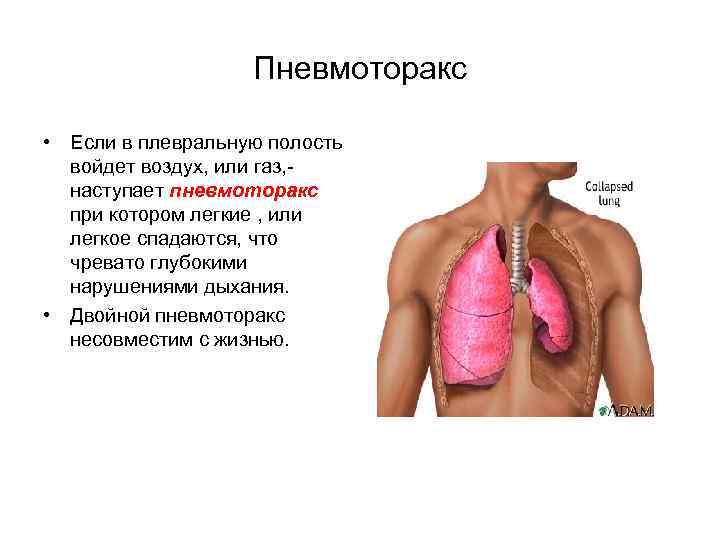 Пневмоторакс • Если в плевральную полость войдет воздух, или газ, наступает пневмоторакс при котором
