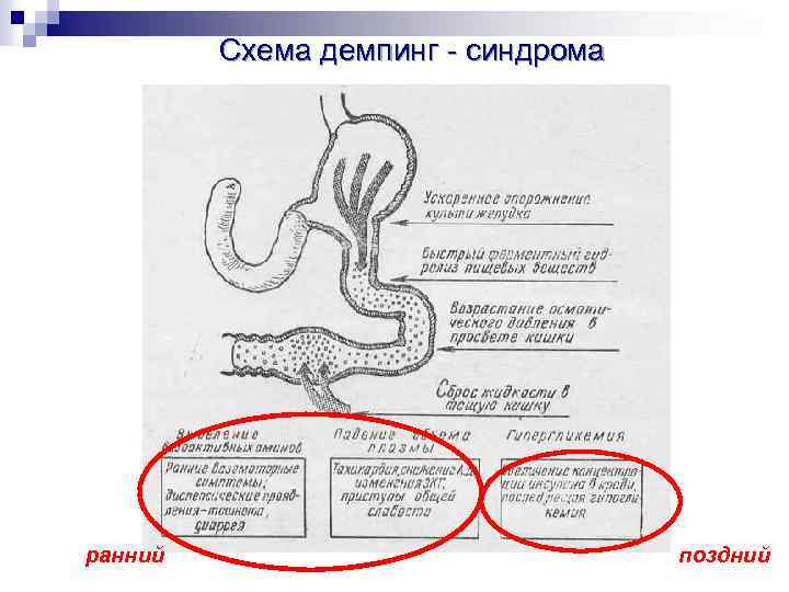 Корнилова схема похмелье