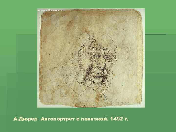 А. Дюрер Автопортрет с повязкой. 1492 г. 