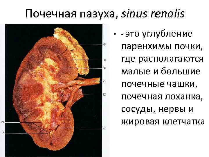 Образование почечного синуса