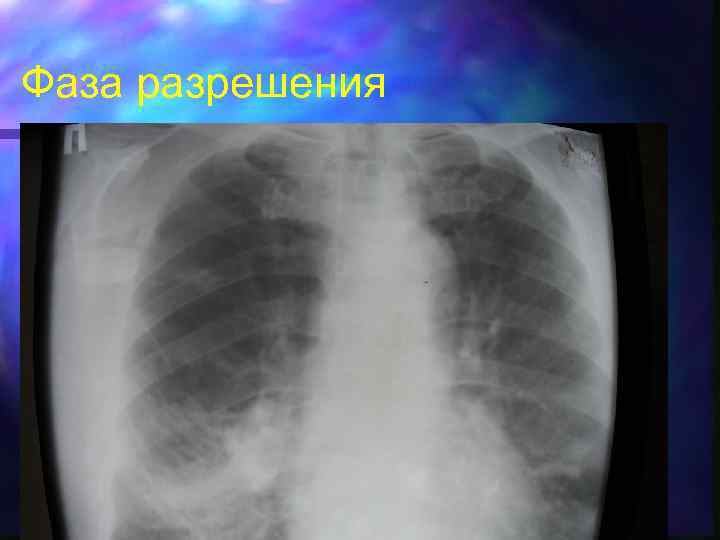 Фаза разрешения 