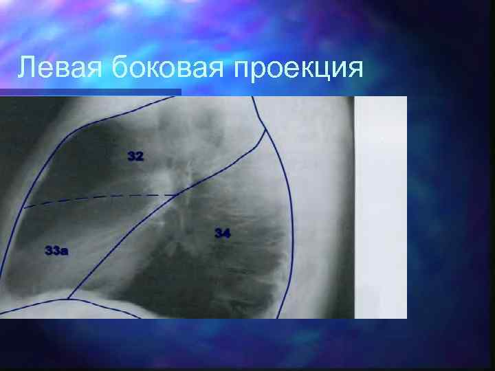 Левая боковая проекция 
