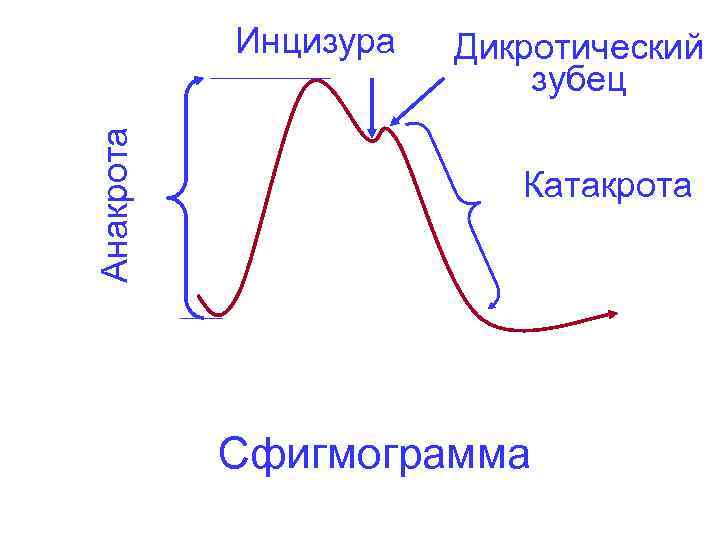 Анакрота Инцизура Дикротический зубец Катакрота Сфигмограмма 