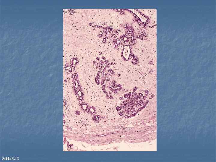 Slide 8. 13 