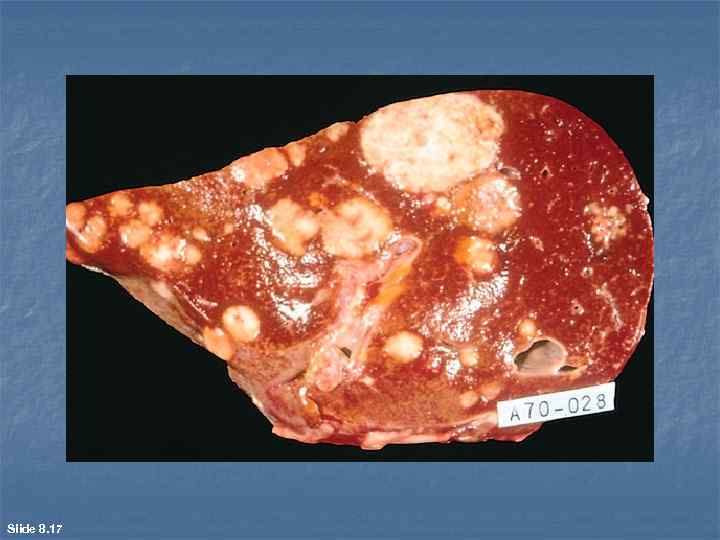 Slide 8. 17 