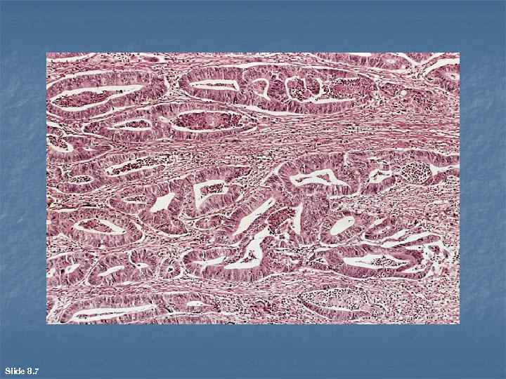 Slide 8. 7 