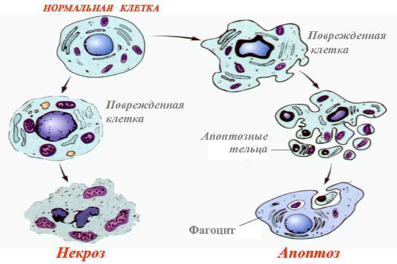 НОРМАЛЬНАЯ КЛЕТКА Поврежденная клетка Апоптозные тельца Фагоцит Некроз Апоптоз 