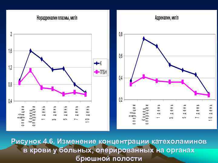 Рисунок 4. 6. Изменение концентрации катехоламинов в крови у больных, оперированных на органах брюшной