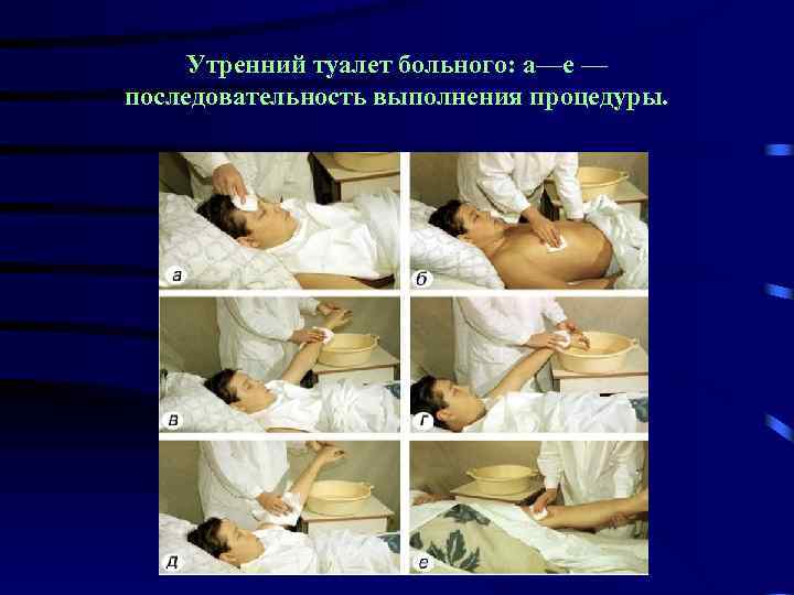 Утренний туалет больного: а—е — последовательность выполнения процедуры. 