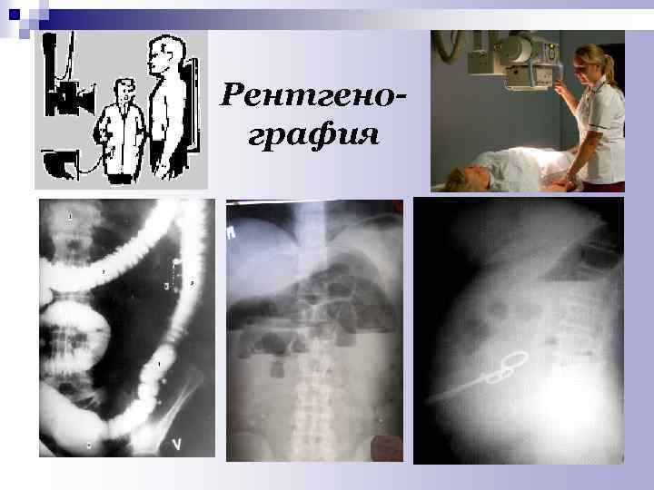 Рентгенография 
