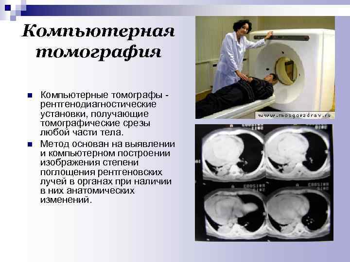 Компьютерная томография n n Компьютерные томографы рентгенодиагностические установки, получающие томографические срезы любой части тела.