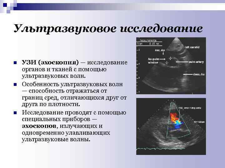 Ультразвуковое исследование n n n УЗИ (эхоскопия) — исследование органов и тканей с помощью