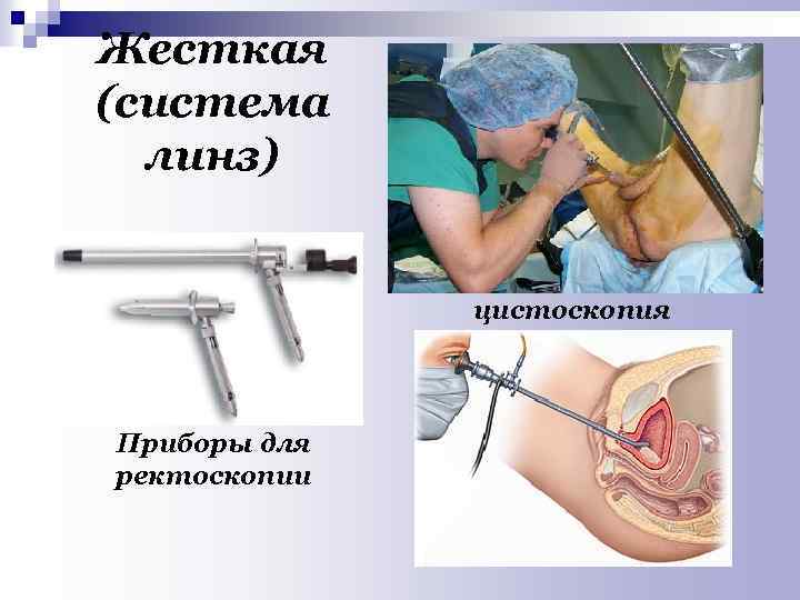 Жесткая (система линз) цистоскопия Приборы для ректоскопии 