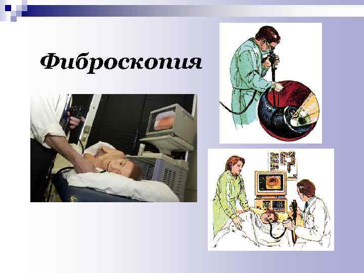 Фиброскопия 