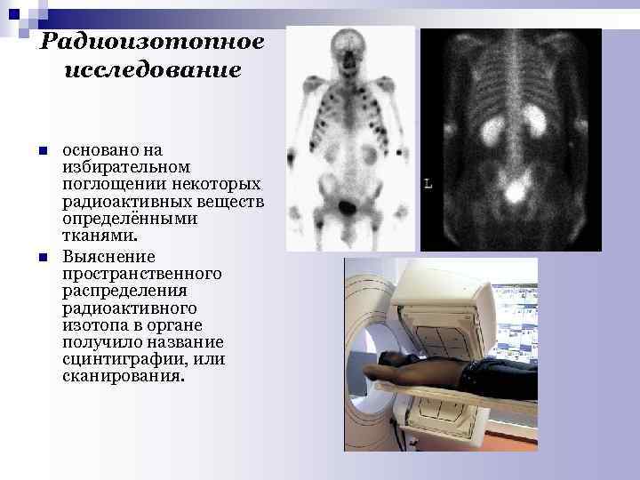 Радиоизотопное исследование n n основано на избирательном поглощении некоторых радиоактивных веществ определёнными тканями. Выяснение