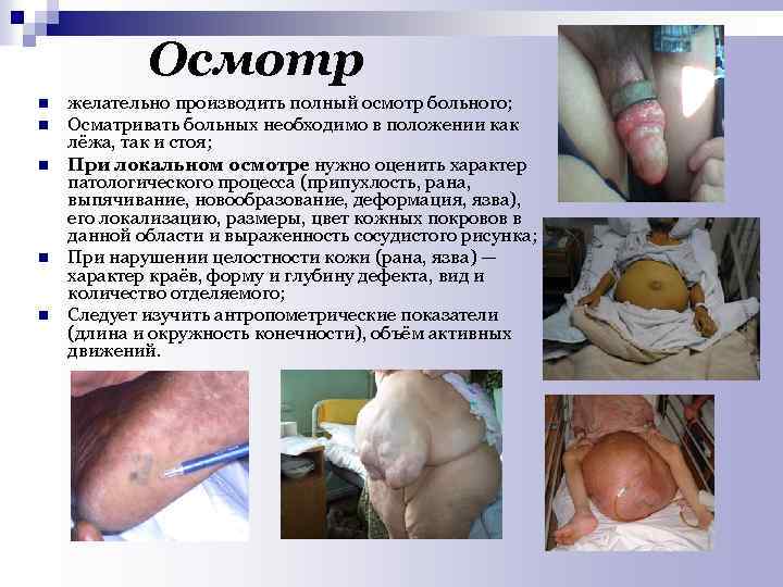 Осмотр n n n желательно производить полный осмотр больного; Осматривать больных необходимо в положении