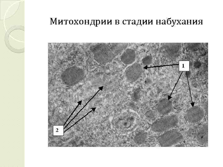 Митохондрии в стадии набухания 