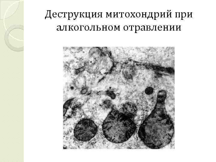 Деструкция митохондрий при алкогольном отравлении 