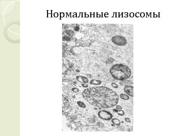 Нормальные лизосомы 