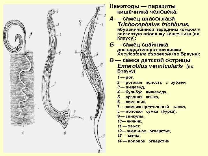 Нематоды — паразиты кишечника человека. А — самец власоглава Trichocephalus trichiurus, вбуравившийся передним концом