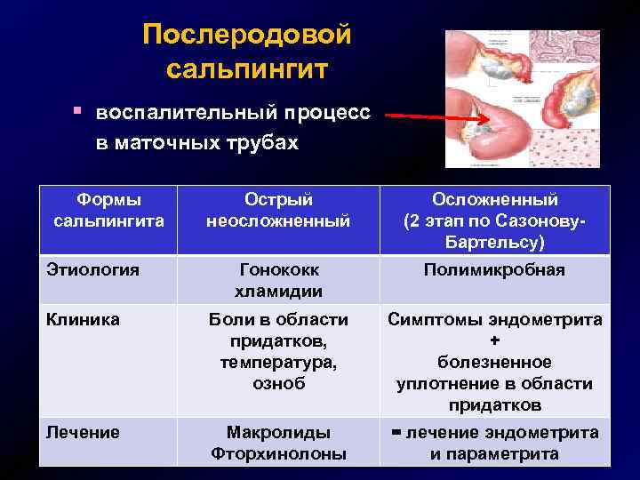 Послеродовой сальпингит § воспалительный процесс в маточных трубах Формы сальпингита Острый неосложненный Осложненный (2