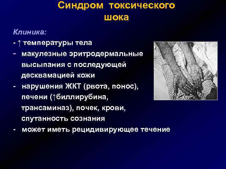 Синдром токсического шока Клиника: - ↑ температуры тела - макулезные эритродермальные высыпания с последующей