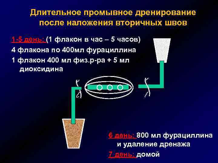 Длительное промывное дренирование после наложения вторичных швов 1 -5 день: (1 флакон в час