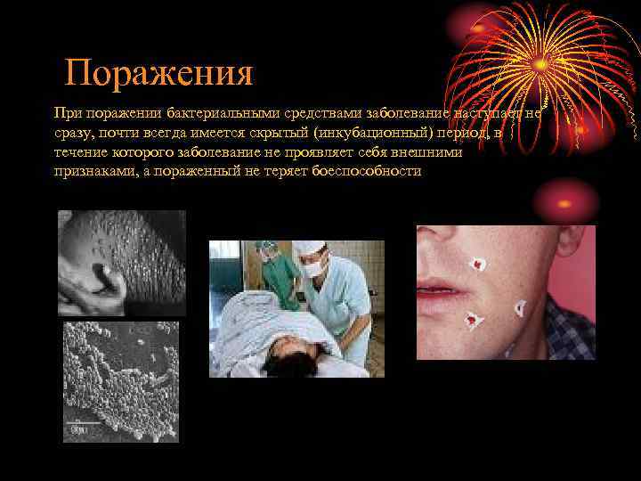 Поражения При поражении бактериальными средствами заболевание наступает не сразу, почти всегда имеется скрытый (инкубационный)