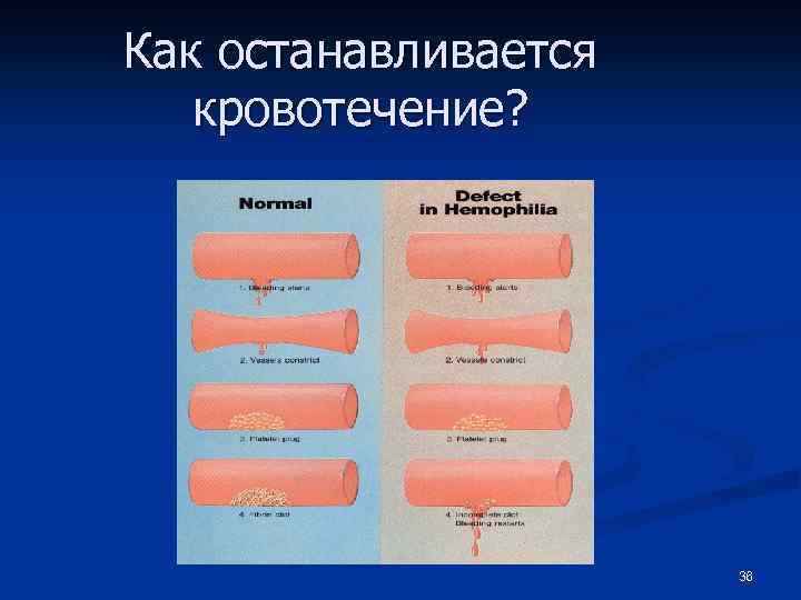 Как останавливается кровотечение? 36 