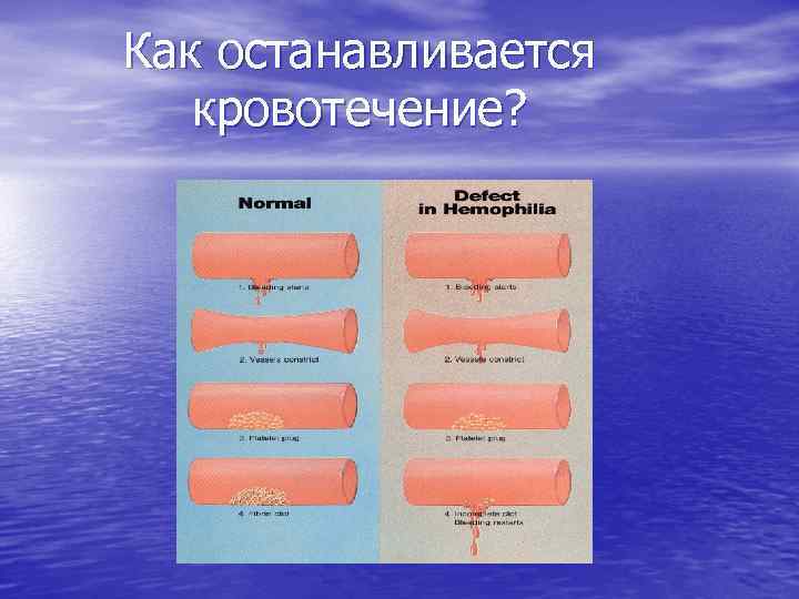 Как останавливается кровотечение? 