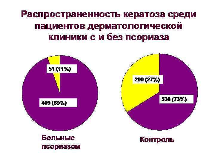 Распространенность кератоза среди пациентов дерматологической клиники с и без псориаза 51 (11%) 200 (27%)