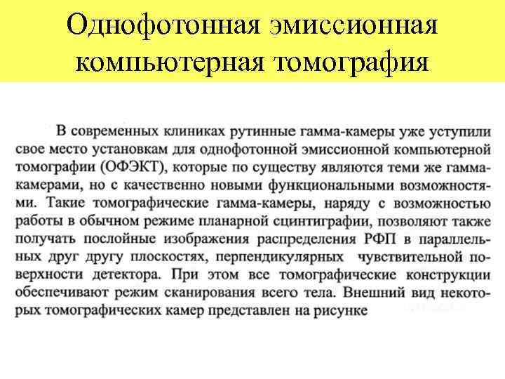 Однофотонная эмиссионная компьютерная томография 
