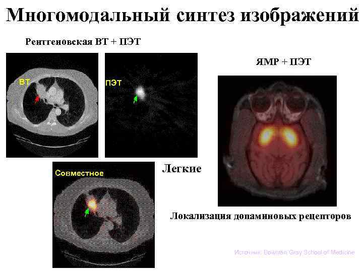 Многомодальный синтез изображений Рентгеновская ВТ + ПЭТ ЯМР + ПЭТ ВТ ПЭТ Совместное Легкие