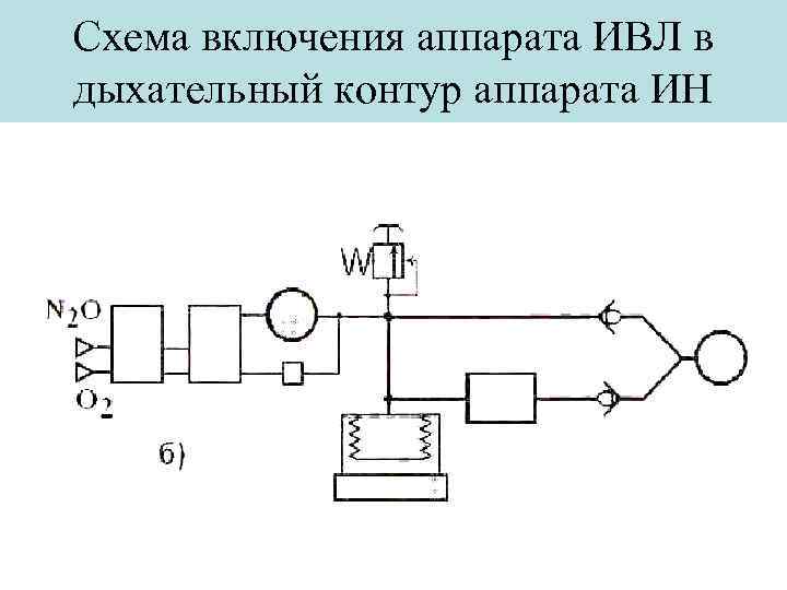 Структурная схема аппарата ивл