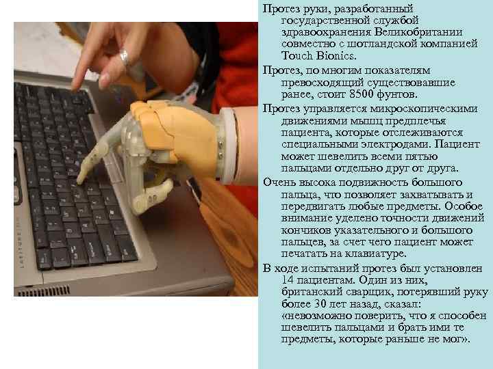 Протез руки, разработанный государственной службой здравоохранения Великобритании совместно с шотландской компанией Touch Bionics. Протез,