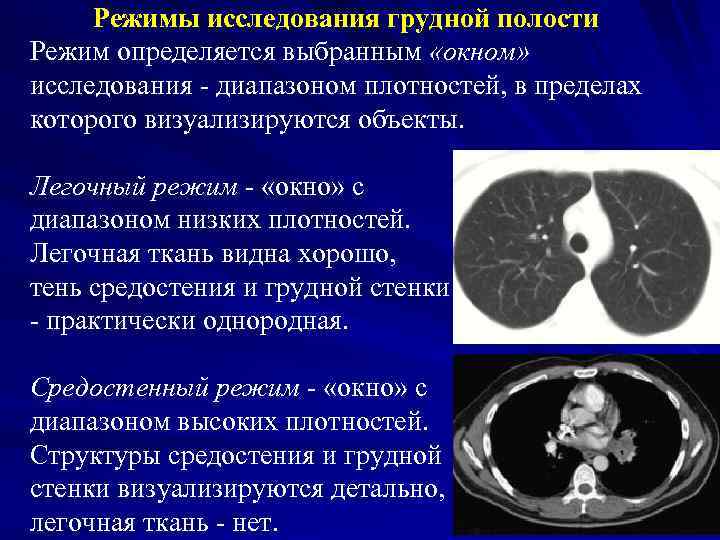 Режимы исследования грудной полости Режим определяется выбранным «окном» исследования - диапазоном плотностей, в пределах