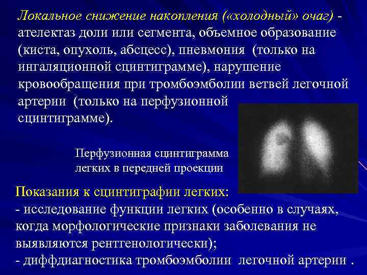 Локальное снижение накопления ( «холодный» очаг) ателектаз доли или сегмента, объемное образование (киста, опухоль,