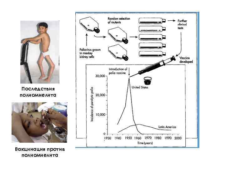 Последствия полиомиелита Вакцинация против полиомиелита 