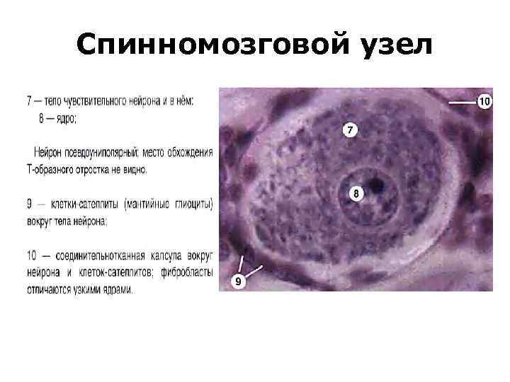 Спинномозговой узел 