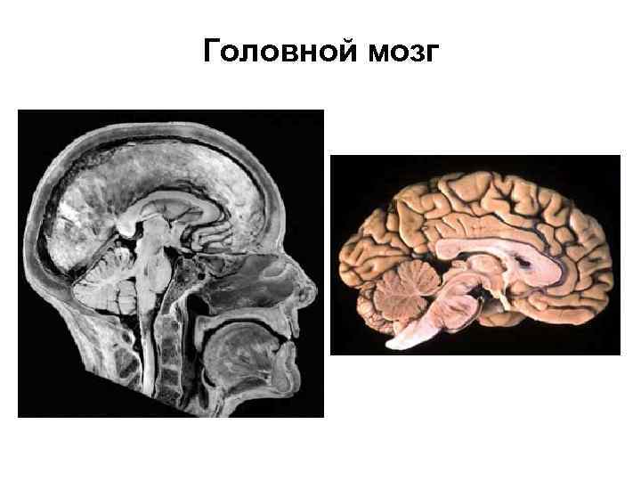 Головной мозг 