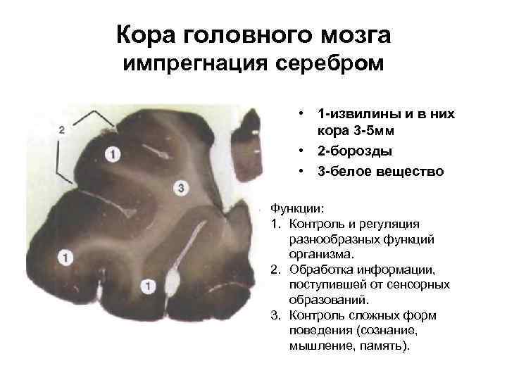 Кора головного мозга импрегнация серебром • 1 извилины и в них кора 3 5