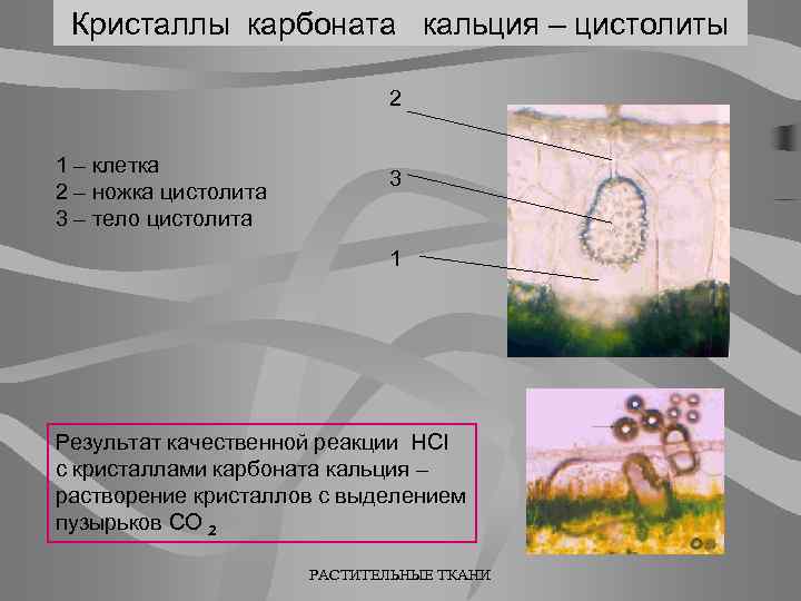 Кристаллы карбоната кальция – цистолиты 2 1 – клетка 2 – ножка цистолита 3