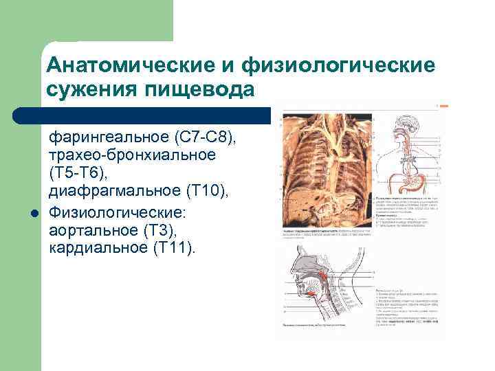 Анатомические и физиологические сужения пищевода l l Анатомические: фарингеальное (С 7 -С 8), трахео-бронхиальное