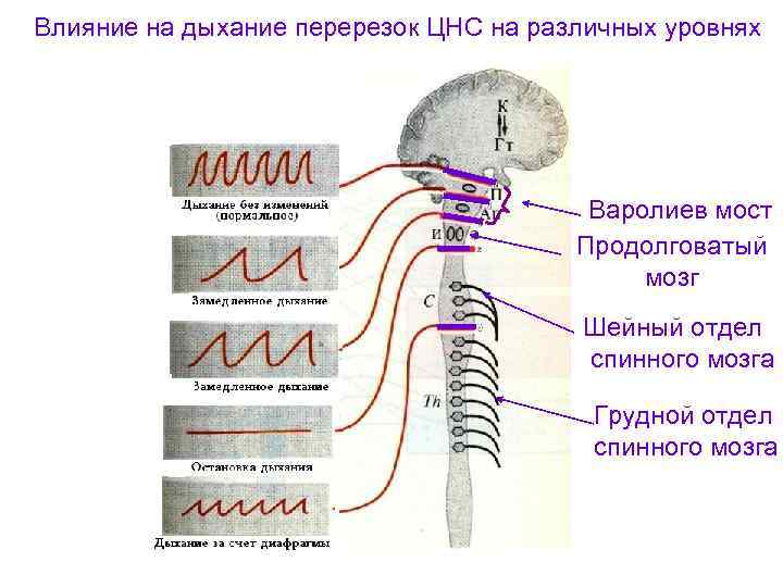Влияние на дыхание перерезок ЦНС на различных уровнях Варолиев мост Продолговатый мозг Шейный отдел