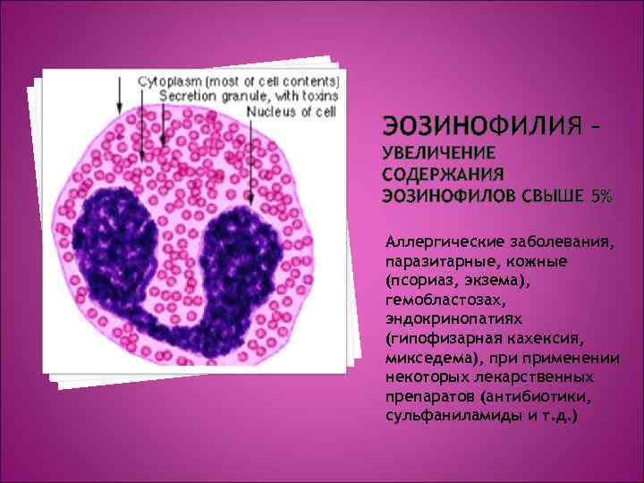 ЭОЗИНОФИЛИЯ – УВЕЛИЧЕНИЕ СОДЕРЖАНИЯ ЭОЗИНОФИЛОВ СВЫШЕ 5% Аллергические заболевания, паразитарные, кожные (псориаз, экзема), гемобластозах,