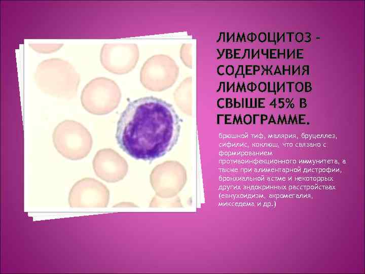 ЛИМФОЦИТОЗ – УВЕЛИЧЕНИЕ СОДЕРЖАНИЯ ЛИМФОЦИТОВ СВЫШЕ 45% В ГЕМОГРАММЕ. брюшной тиф, малярия, бруцеллез, сифилис,
